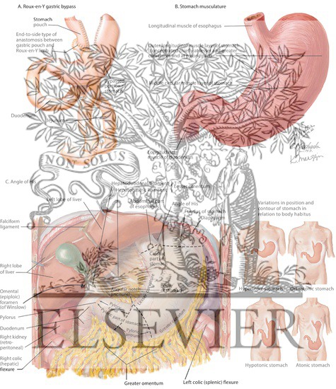 Roux-en-Y Bypass, Stomach Musculature, and Angle of His