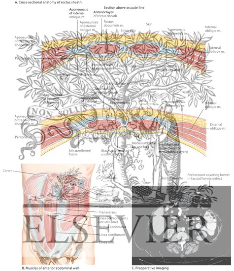 Abdominal Wall Anatomy and Rectus Sheath