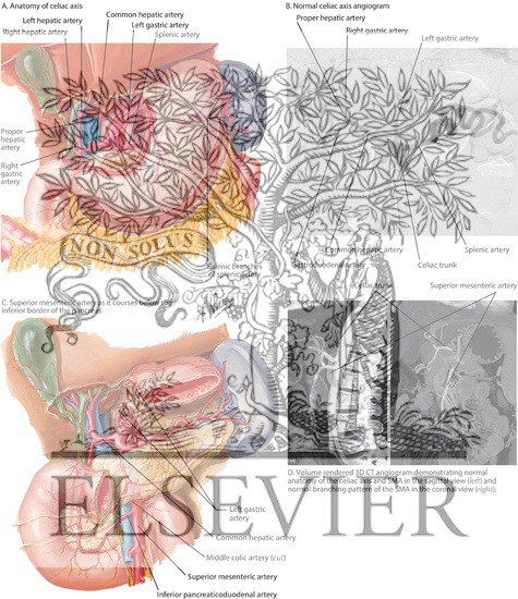 Watermarked preview of labeled image: Celia Axis an Superior Mesenteric Artery (SMA)