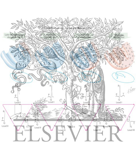 Watermarked preview of labeled image: End of Depolarization Followed by Repolarization