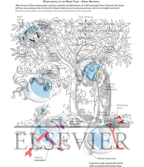 Watermarked preview of labeled image: Atrial Septation