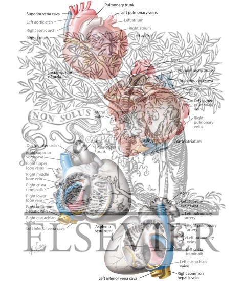 Watermarked preview of labeled image: Anomalies of the Atria