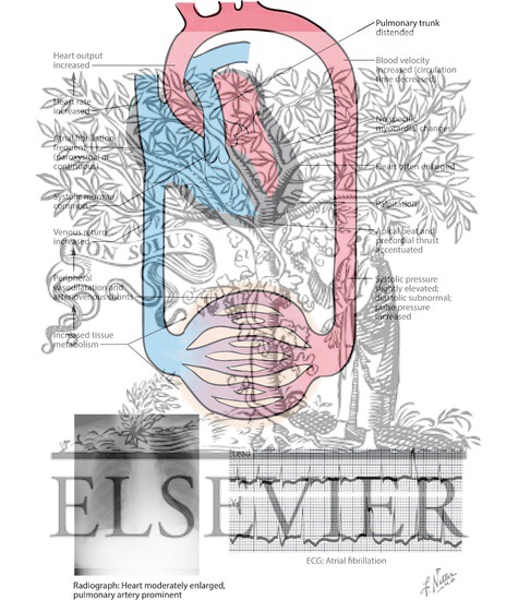 Watermarked preview of labeled image: The Hyperthyroid Heart