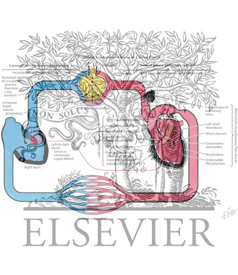 Watermarked preview of labeled image: Pulmonary Congestion or Edema of Cardiac Origin
