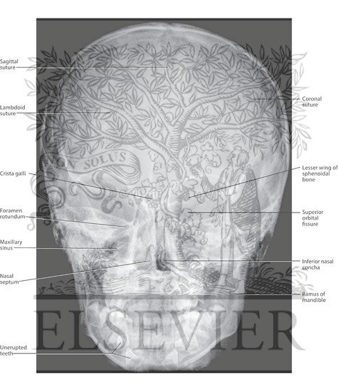 Skull: Anteroposterior Radiograph