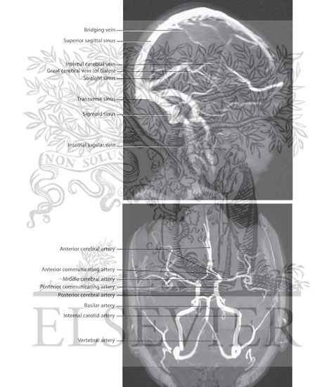 Cranial Imaging (MRV and MRA)