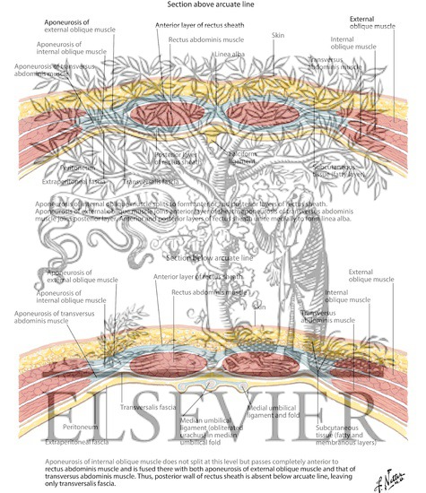 Watermarked preview of labeled image: Rectus Sheath: Cross Sections 