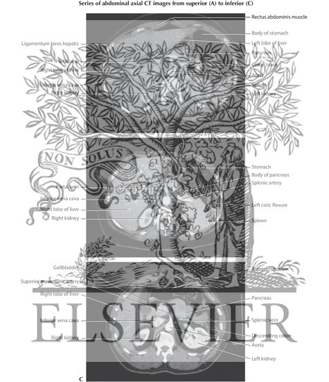 Watermarked preview of labeled image: Abdominal Scans: Axial CT Images