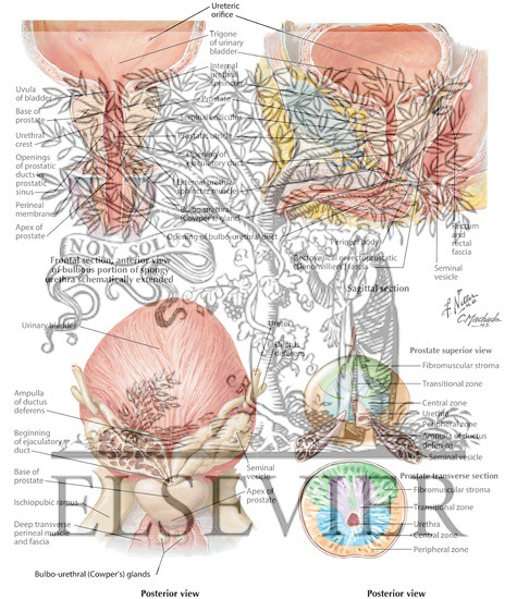Watermarked preview of labeled image: Prostate and Seminal Vesicles