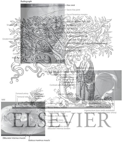 Watermarked preview of labeled image: Hip Radiograph, Arthrogram, MR and PETCT Fusion