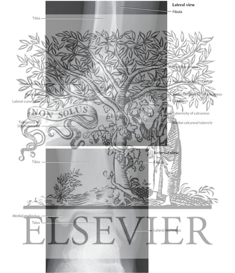 Watermarked preview of labeled image: Ankle: Radiographs