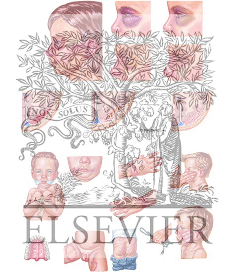Watermarked preview of unlabeled image: Child Abuse: Staging of Injuries and Injury Patterns