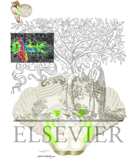 Cerebellar Peduncles