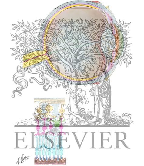 Watermarked preview of unlabeled image: Eye