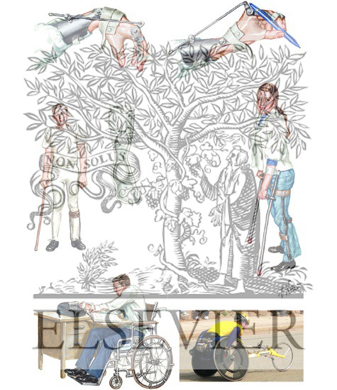 Watermarked preview of unlabeled image: Spinal Cord Injury Medical Issues