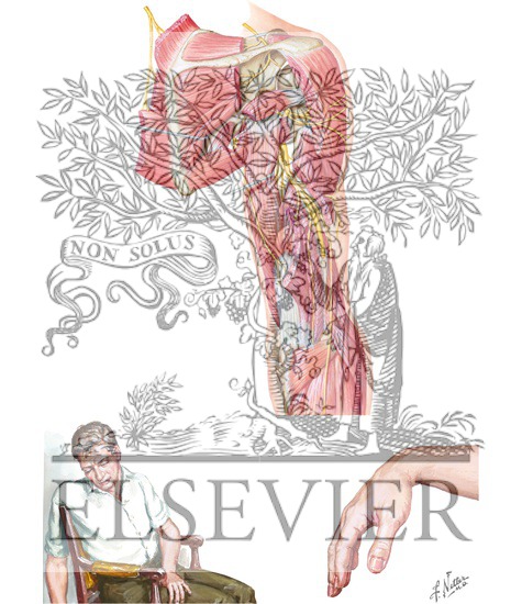 Watermarked preview of unlabeled image: Radial Nerve