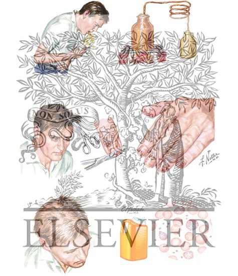 Watermarked preview of unlabeled image: Peripheral Neuropathy Cause by Heavy Metal Poisoning