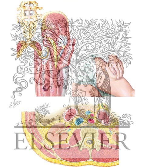 Watermarked preview of unlabeled image: Diagnosis of Hip, Buttock, and Back Pain