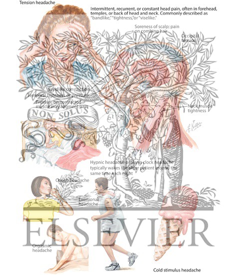 Tension-Type Headache and Other Benign Episodic and Chronic Headaches
