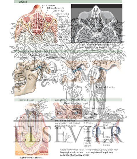 Watermarked preview of labeled image: Contiguous Structure Headaches