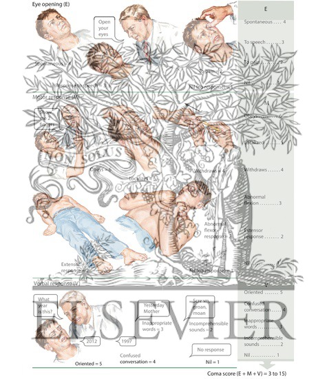 Watermarked preview of labeled image: Glasgow Comma Scale