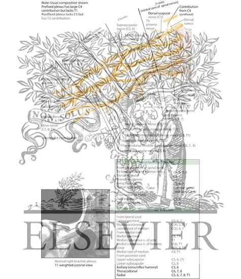 Watermarked preview of labeled image: Brachial Plexus: Schema
