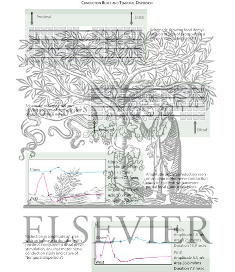 Watermarked preview of labeled image: Propagation of the Action Potential