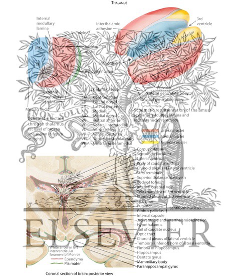 Watermarked preview of labeled image: Thalamic Pain Syndrome