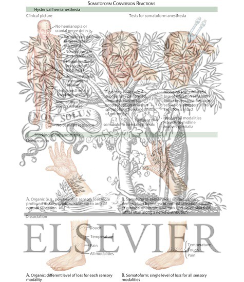 Watermarked preview of labeled image: Neurologic Evaluation of the Somatoform Patient: Somatoform Conversion Reactions