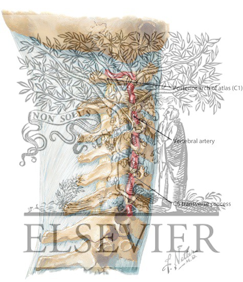 Watermarked preview of labeled image: Vertebral Artery, Neck