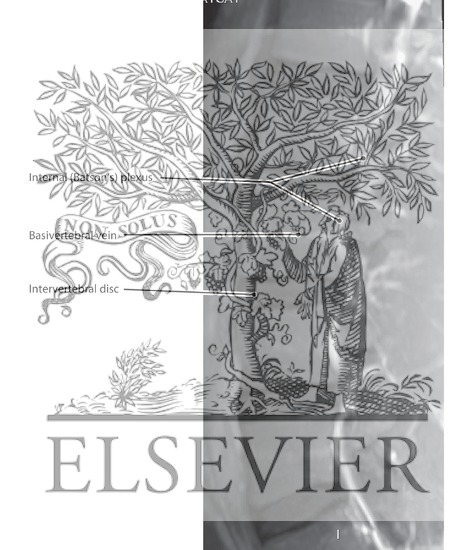 Watermarked preview of labeled image: Vertebral Venous Plexuses