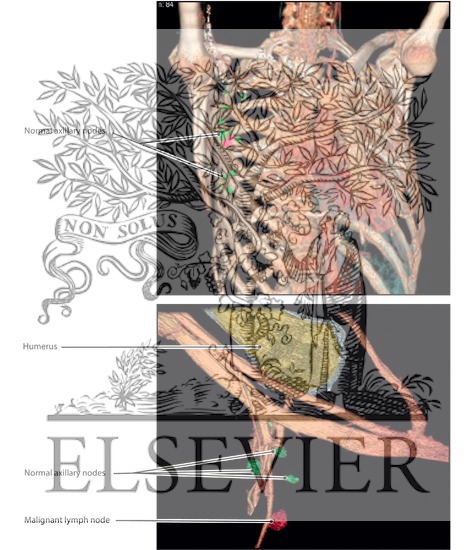 Watermarked preview of labeled image: Lymph Nodes of the Axilla (Continued)