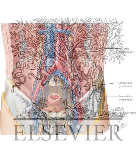 Preaortic, Iliac, and Inguinal Lymph Nodes