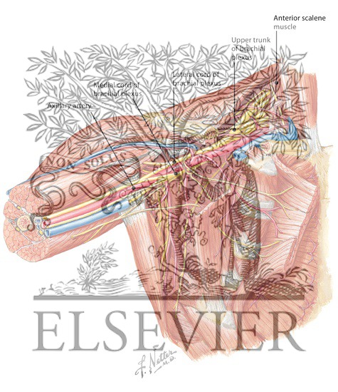 Watermarked preview of labeled image: Axilla Dissection: Anterior View