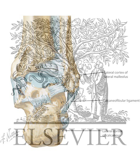 Watermarked preview of labeled image: Calcaneus