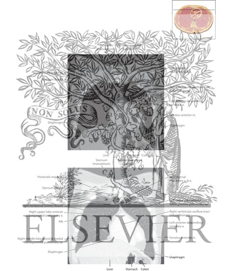 Watermarked preview of labeled image: Soft Tissue and Lung Coronal 3