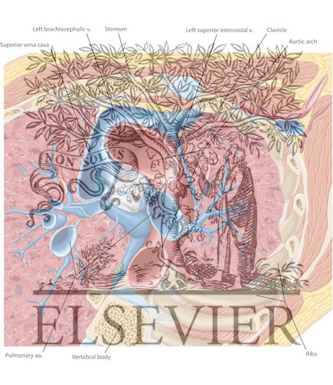 Watermarked preview of labeled image: Venous Axial 1