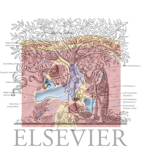Watermarked preview of labeled image: Cardiac CT Axial 1