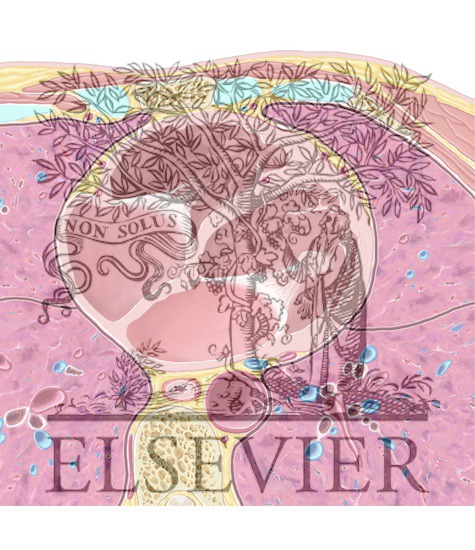 Watermarked preview of unlabeled image: Cardiac CT Axial 31