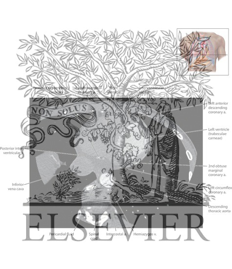 Radiology essay topics picture