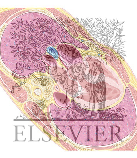 Watermarked preview of unlabeled image: Cardiac MR 3-Chamber 1