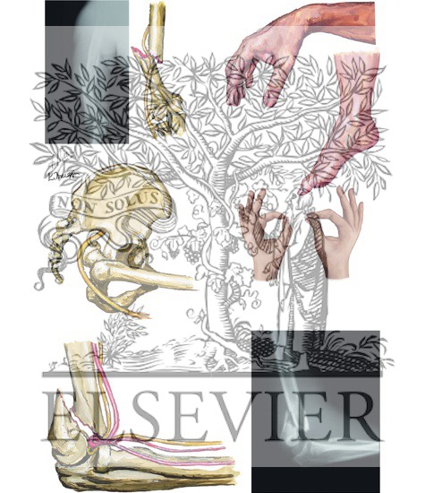 Neurovascular Injury