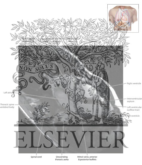 Watermarked preview of labeled image: Cardiac MR 3-Chamber 1