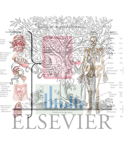 Watermarked preview of labeled image: Etiology and Prevalence of Hematogenous Osteomyelitis