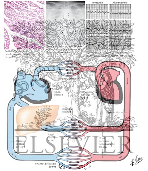 Watermarked preview of labeled image: Pathophysiology of Heart Failure