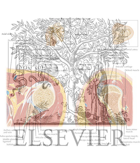 Watermarked preview of labeled image: Muscles of Rotator Cuff: Cross Sections