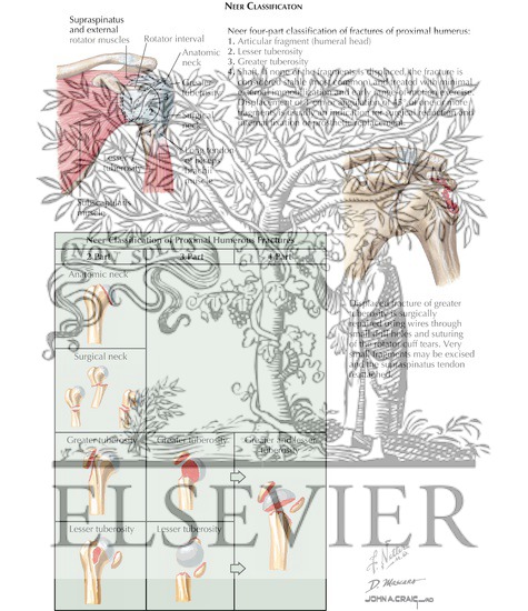 Neer Classification