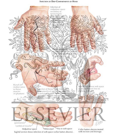 The Netter Collection Of Medical Illustrations Musculoskeletal System