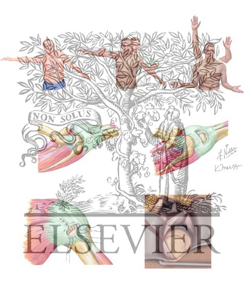 Watermarked preview of unlabeled image: Rotator Cuff Injury