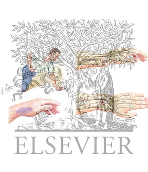 Watermarked preview of unlabeled image: Distal Radial (Colles') Fracture